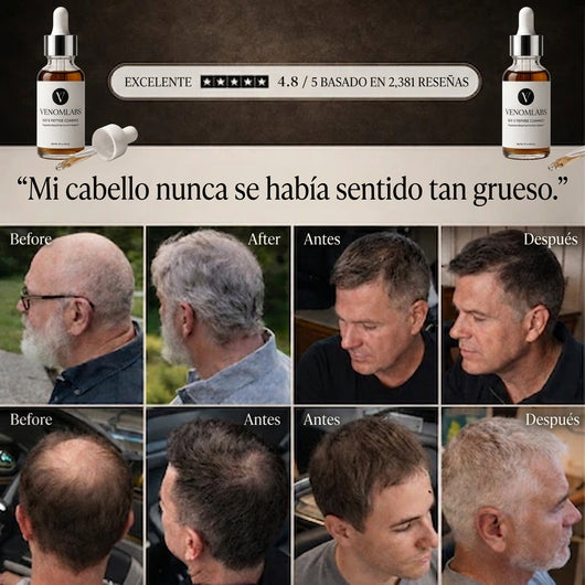 Peptidos FST-5 | Complejo de crecimiento de cabello de Venom